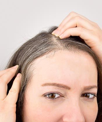 Top 5 Things You Need to Know About Premature Gray Hair